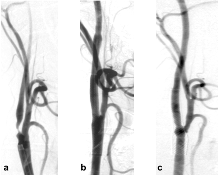 Fig 3.