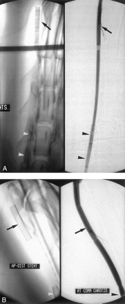 Fig 1.