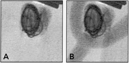 Fig 4.
