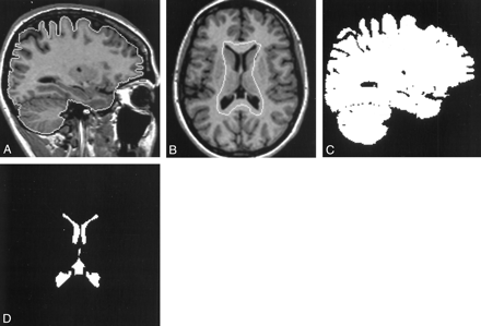 Fig 1.