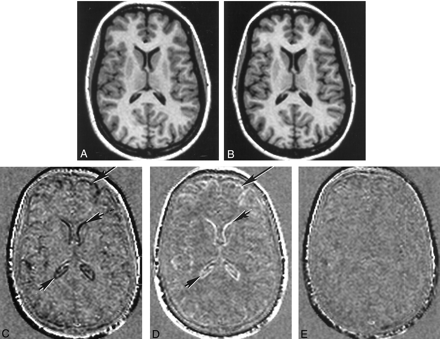 Fig 2.