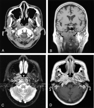 Fig 2.
