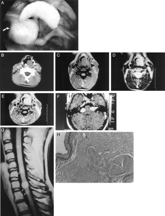 Fig 1.