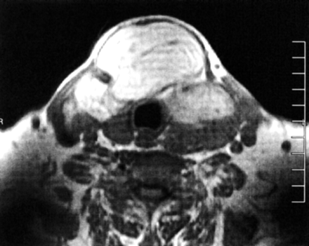 Fig 2.