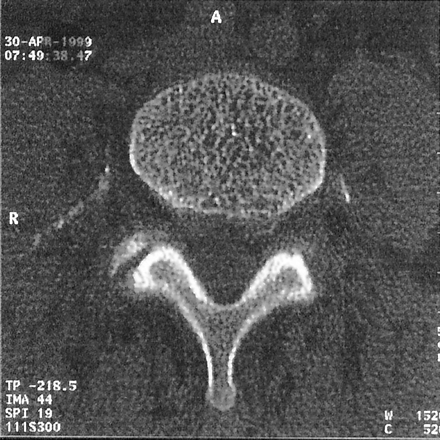 Fig 2.