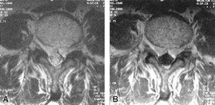 Fig 4.