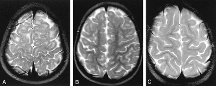 Fig 1.