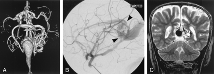 Fig 2.