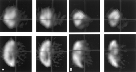 Fig 1.