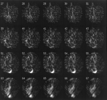 Fig 2.