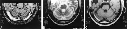 Fig 1.