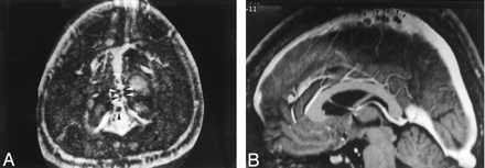Fig 2.