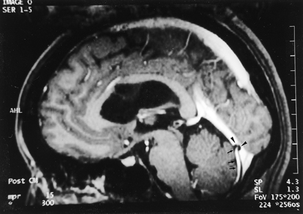 Fig 6.
