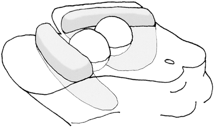 Fig 1.