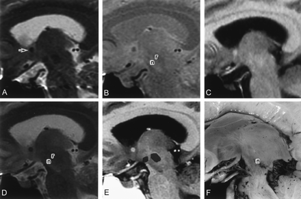Fig 5.