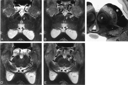 Fig 6.