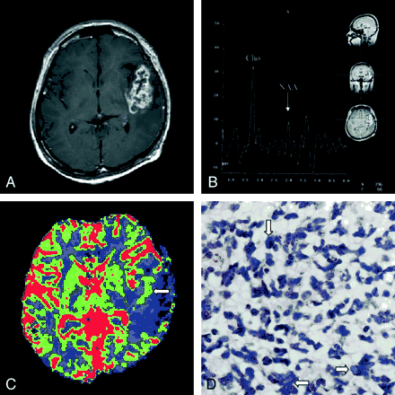 Fig 2.