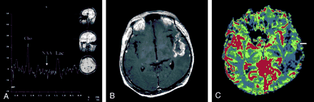 Fig 3.