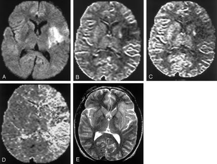 Fig 3.