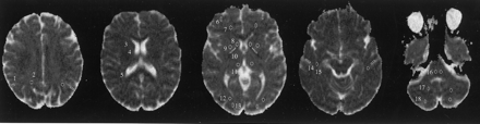 Fig 1.