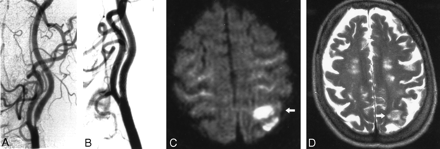 Fig 3.