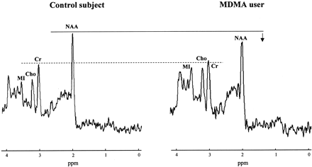 Fig 2.