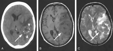 Fig 3.