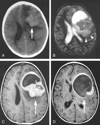Fig 4.