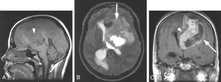 Fig 5.