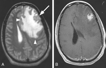 Fig 6.