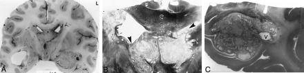 Fig 2.