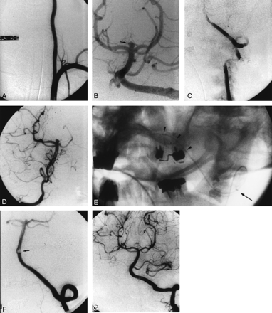 Fig 2.