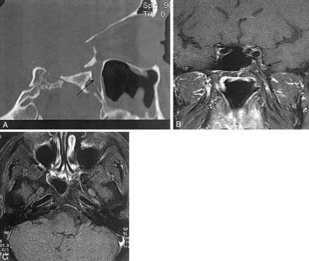 Fig 2.
