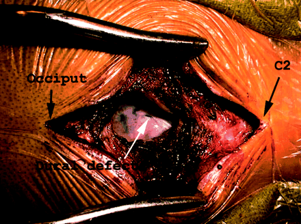 Fig 3.