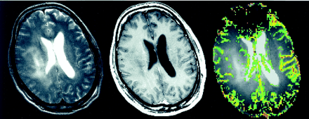 Fig 2.