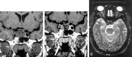 Fig 1.