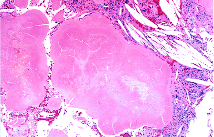 Fig 2.