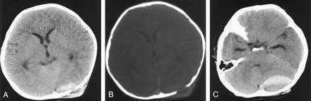 Fig 1.