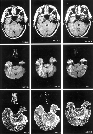 Fig 1.