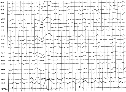 Fig 2.