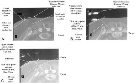 Fig 2.