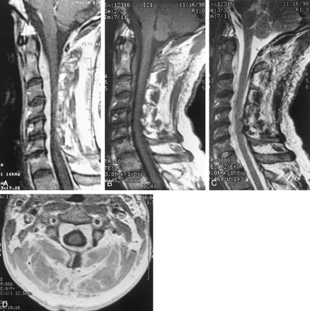 Fig 1.