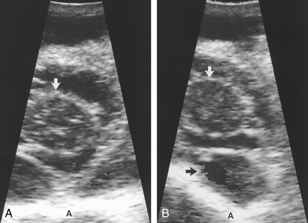 Fig 2.