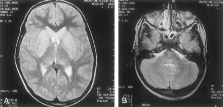 Fig 2.