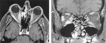 Fig 1.