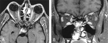Fig 2.