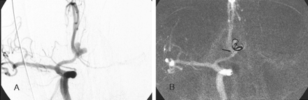 Fig 2.