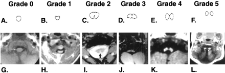Fig 2.