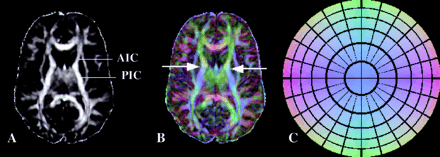 Fig 3.