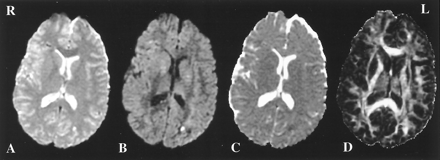 Fig 4.